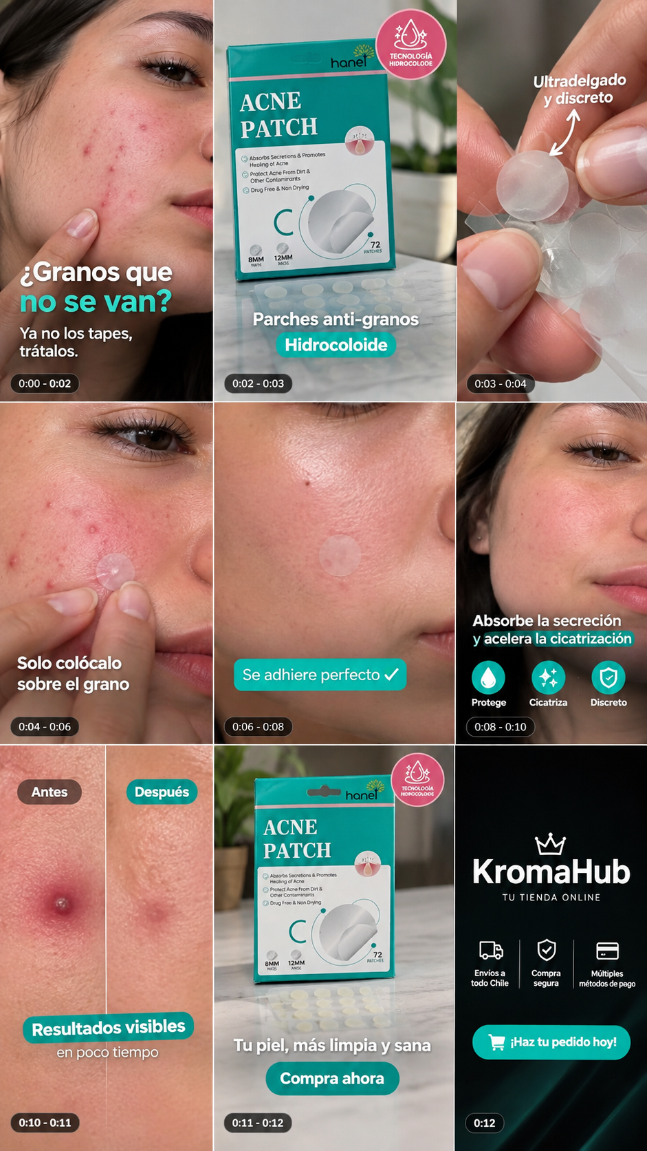 ✨ Parches Anti-Granos Hanel Acne Patch